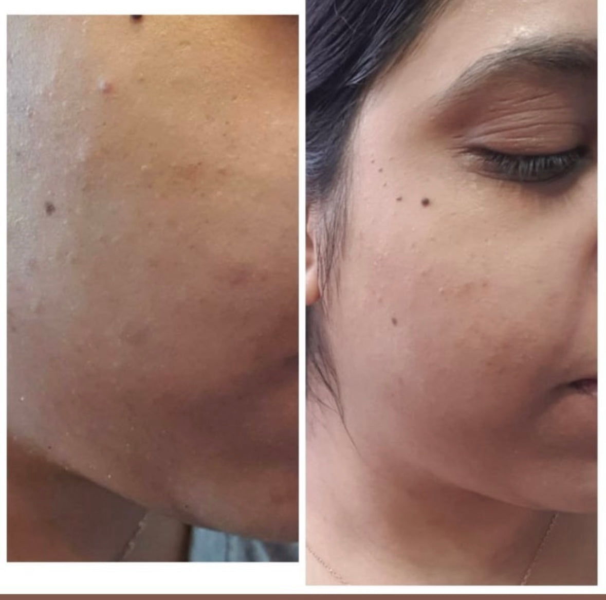 TYPE O FACIAL OIL 30ml